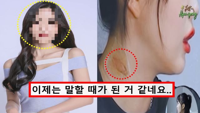 왼쪽 - 레인보우 출신 조현영 프로필 사진 / 오른쪽 - 조현영 '키스마크' 논란 사진