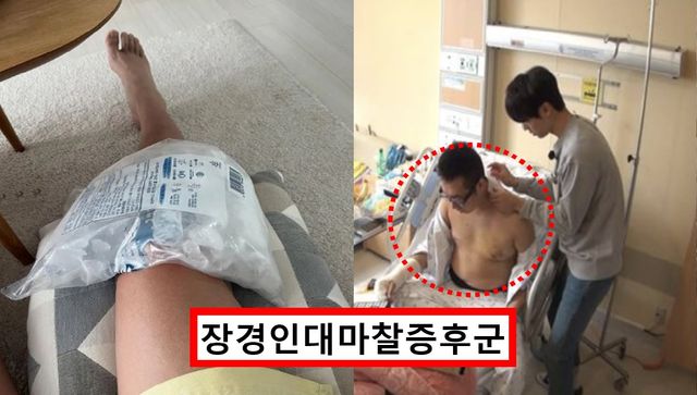 김영철 건강