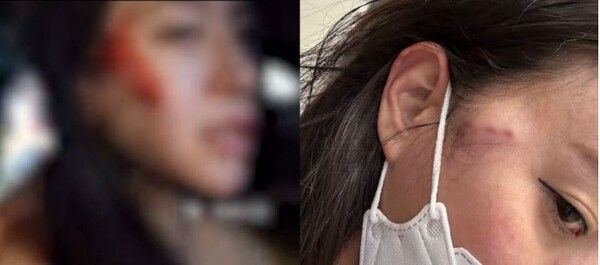 유튜버 감성여울 피해상태&nbsp;