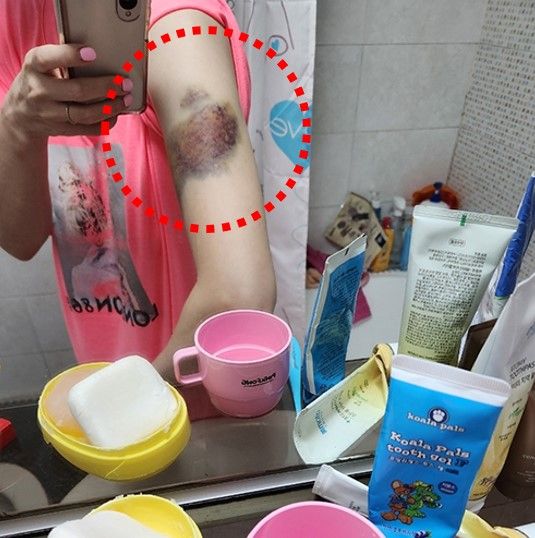 인천 스토킹 가해자