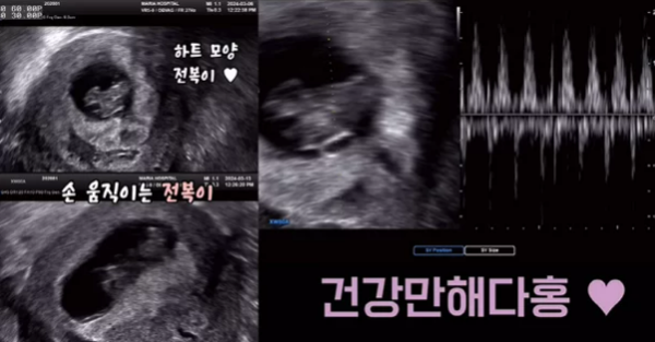 김다예가 공개한 초음파 / 사진 = 인스타그램