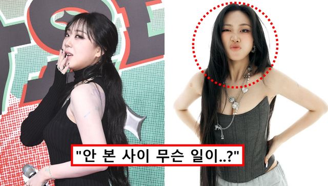 이영지 다이어트 위고비 투약 뼈말라 근황