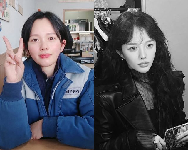 정지소 성형 나이 본명 근황 얼굴 턱 양악