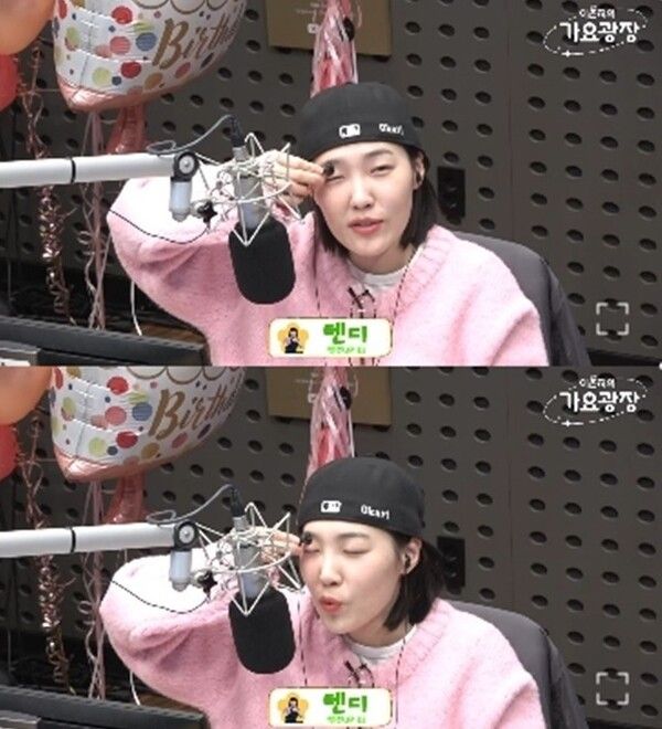 이은지 눈 멍 이유 남자친구 헬스장 부상