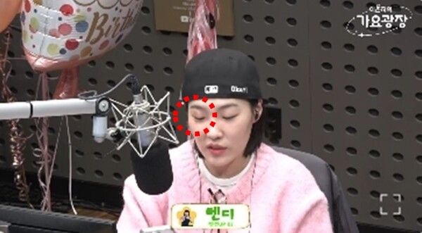 이은지 눈 멍 이유 남자친구 헬스장 부상