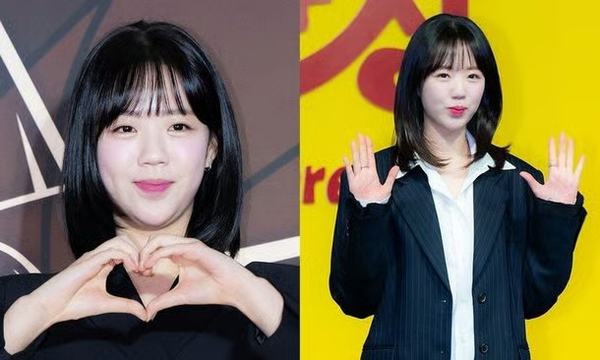 지예은 갑상선 수술 병명 갑상선기능저하증