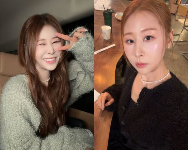 서준맘 박세미 코 성형 근황 개그우먼