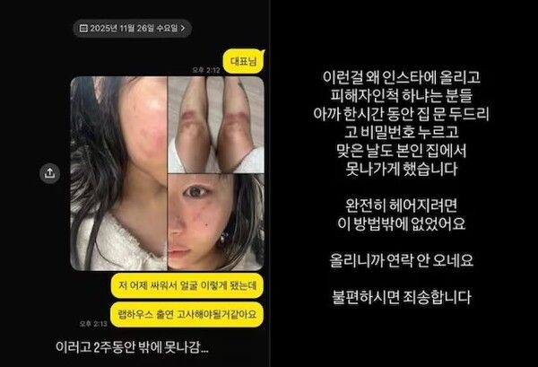 래퍼 재키와이, 방달 데이트 폭력 폭로 한 달 만에 돌연 법적 조치 취소... 왜? / 사진=재키와이 인스타그램