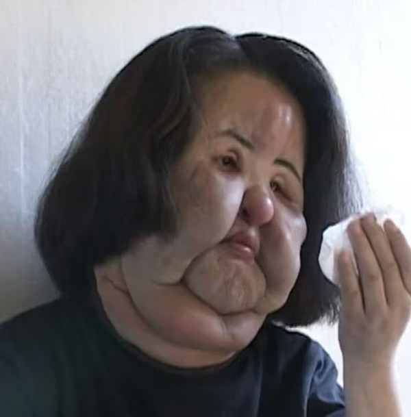 선풍기 아줌마 근황 사망 이유 원인 한혜경