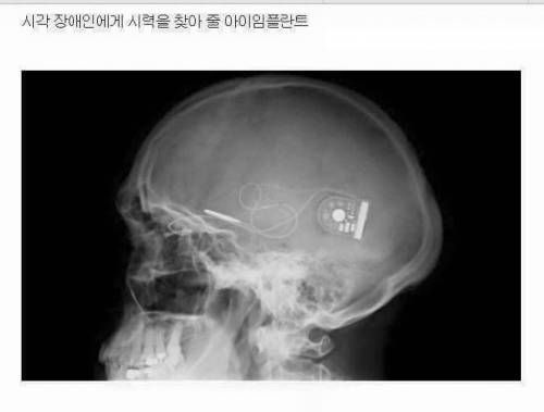 현재 우리 인류의 기술 수준