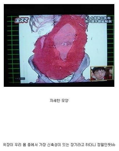 폭식했을 때 사람 위장의 변화