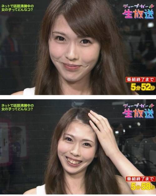 입을 가리는 이유.jpg