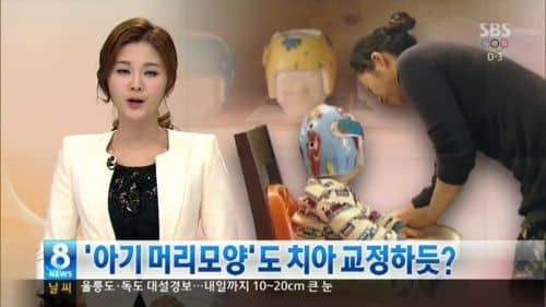 흔한 교정기.jpg