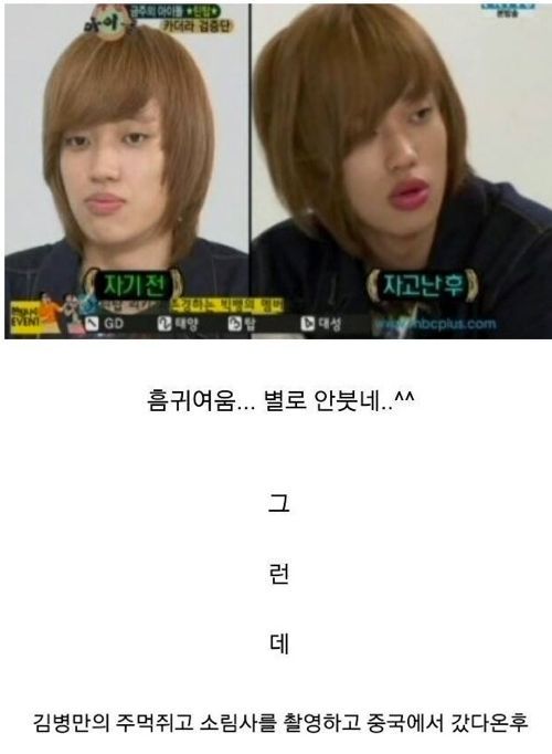 자고일어나면 입술이 붓는다는 아이돌