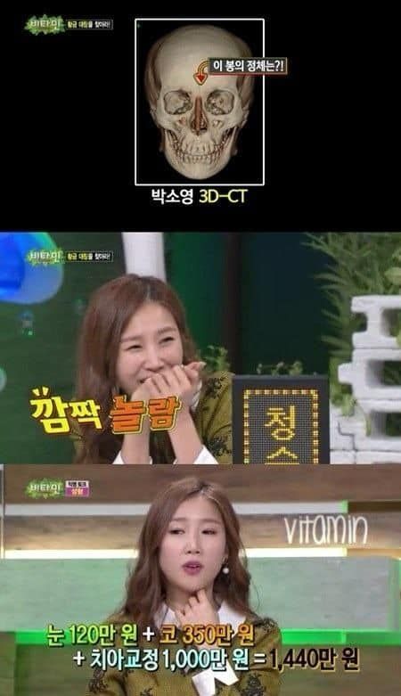 성형 강제 인증.jpg