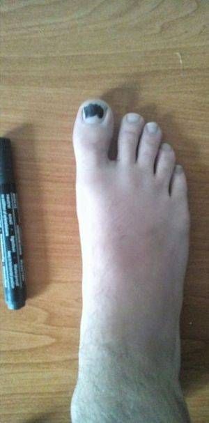 구멍난 양말의 손쉬운 처리법