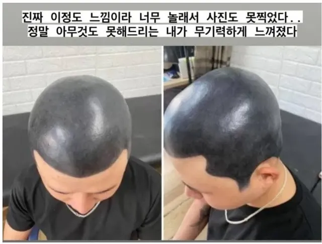 다른데서 망해온 문신 손도 못대고 병원에 보낸 문신사