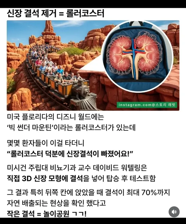신장결석 제거하는방법.jpg