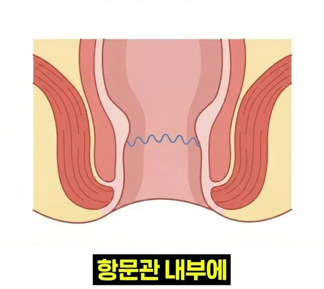 우리 뇌가 방귀와 똥을 구분하는 방법