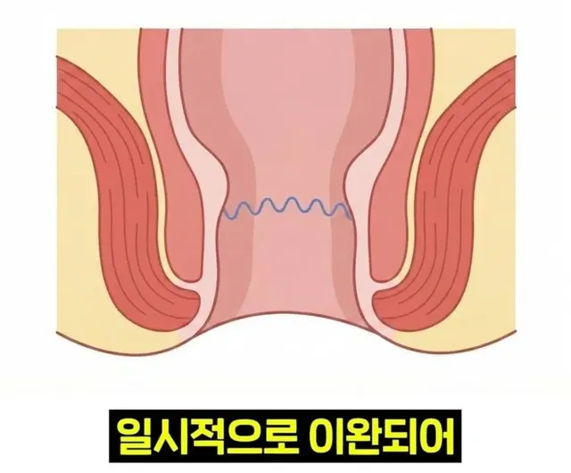 우리 뇌가 방귀와 똥을 구분하는 방법