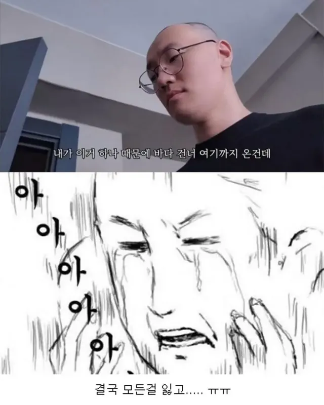 터키로 모발이식 받으러간 남성