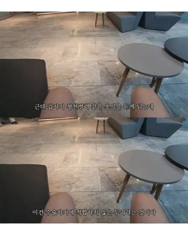 터키로 모발이식 받으러간 남성