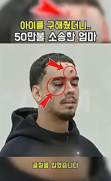 [스압] 아이를 구해줬더니 50만불 소송한 애엄마