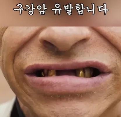 해외에서 먹으면 안되는 열매