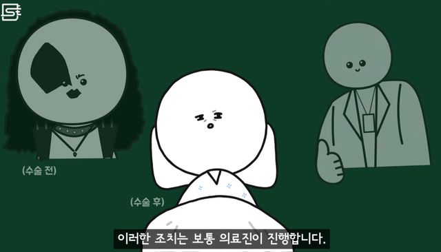 렌즈 낀 상태에서 기절해 병원에 실려오면 어떻게 될까?