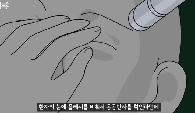 렌즈 낀 상태에서 기절해 병원에 실려오면 어떻게 될까?