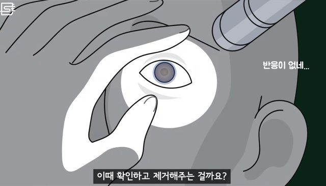 렌즈 낀 상태에서 기절해 병원에 실려오면 어떻게 될까?