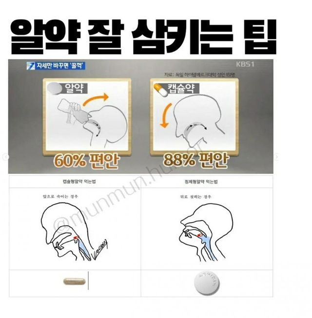 알약 잘 삼키는 법