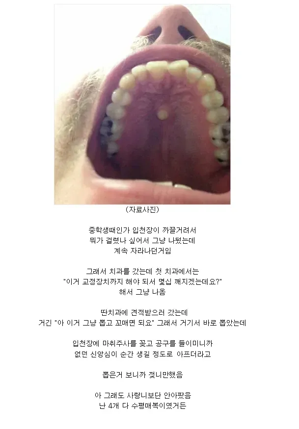 이빨 위치 레전드 .jpg