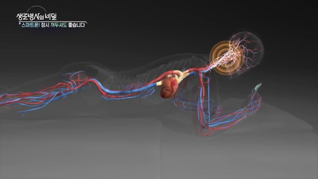 안압 상승시키는 최악의 자세