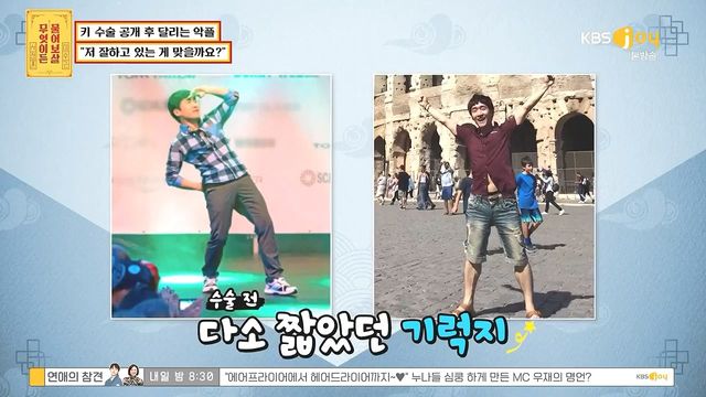 키 크는 수술 성공한 사람 .jpg