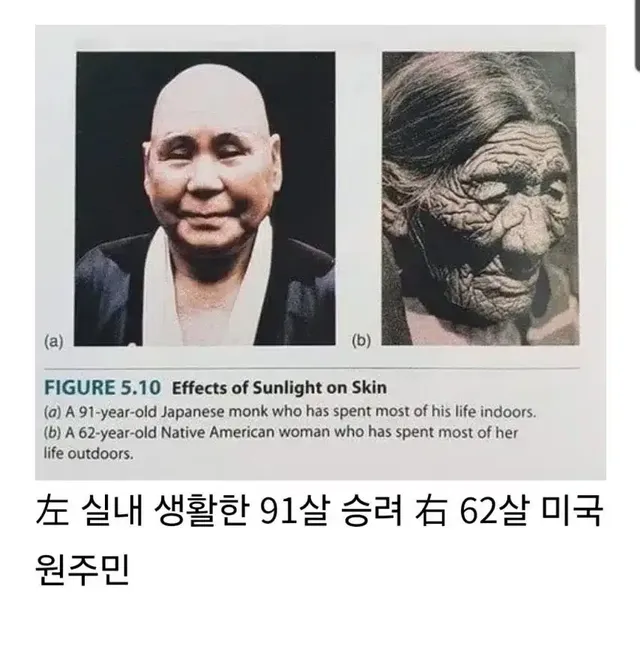 햇빛이 피부에 미치는 영향 사례
