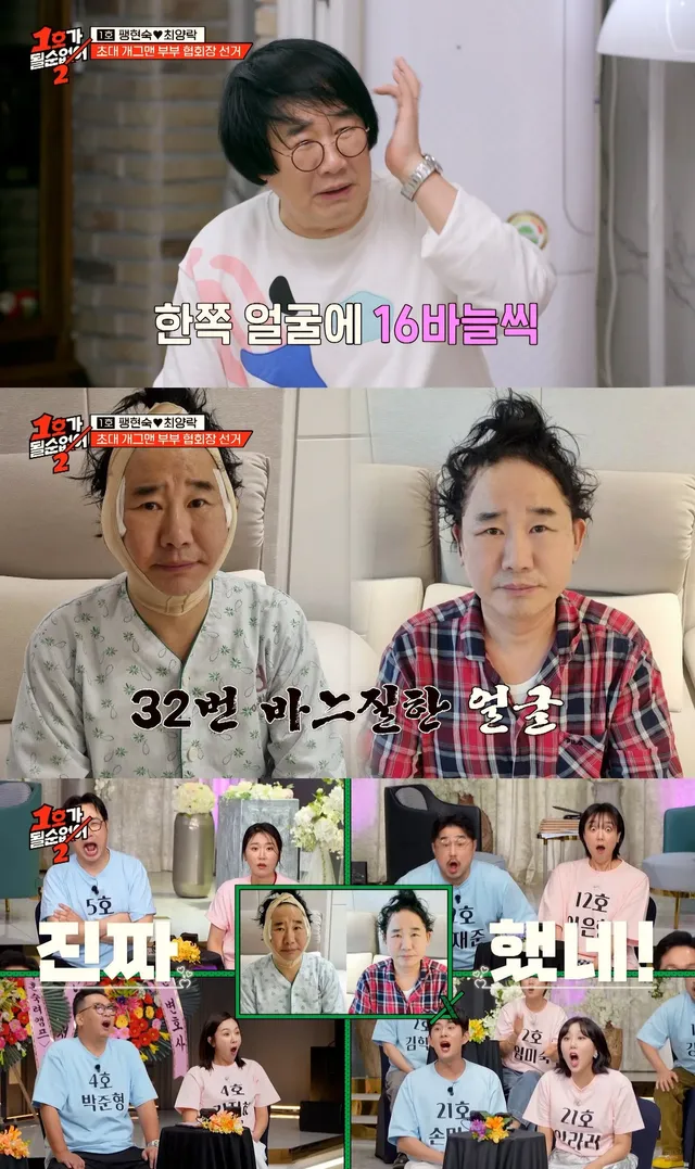 알고 보니 성형 중독이라는 의외의 개그맨