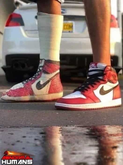 이왕이면 깁스도 브랜드로 해야지