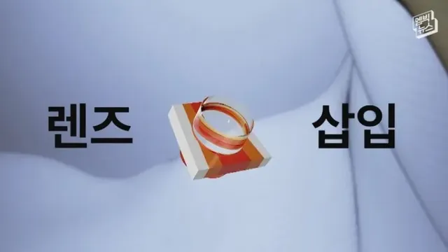 눈에 치아를 넣어 시력을 회복하는 수술