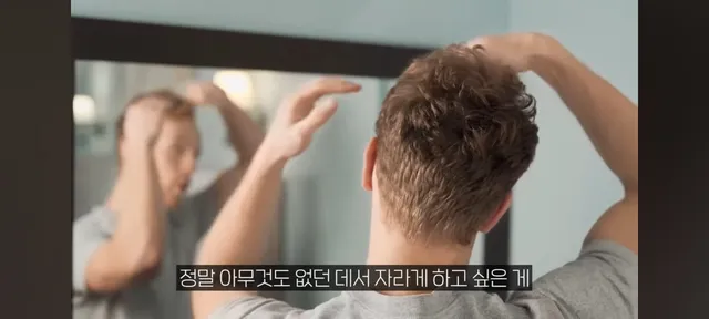 의학이 이렇게 발전했는데 탈모약은 왜 못만들어요?