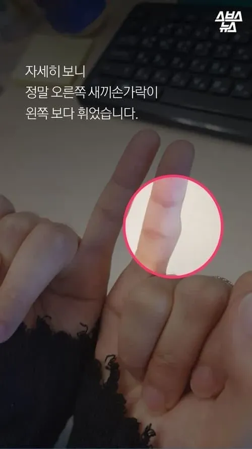 스마마트폰으로 인해 생긴 부작용