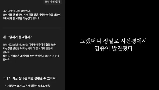 곧 의사를 대신할거 같은 챗gpt 근황