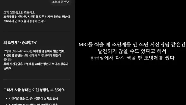 곧 의사를 대신할거 같은 챗gpt 근황