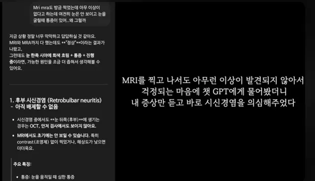 곧 의사를 대신할거 같은 챗gpt 근황