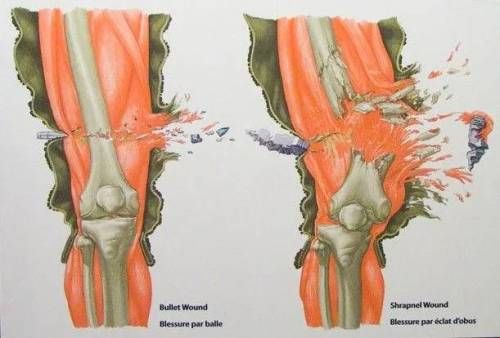 총맞으면 아픈이유