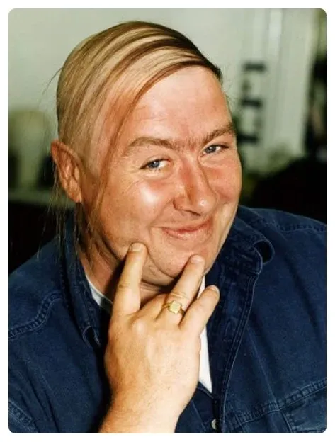 대머리를 가리는법!