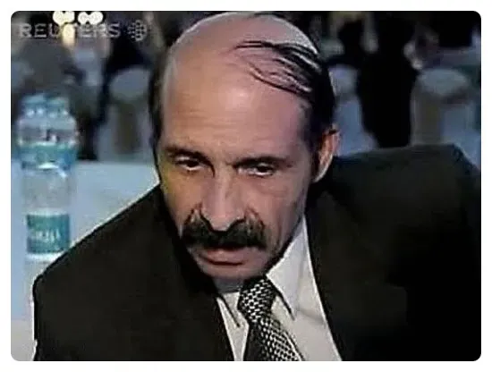 대머리를 가리는법!