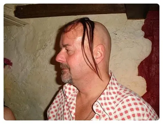 대머리를 가리는법!