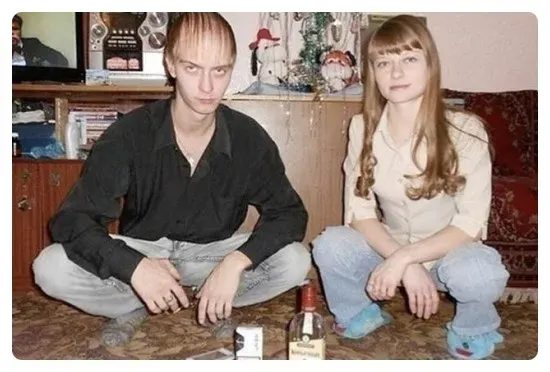 대머리를 가리는법!