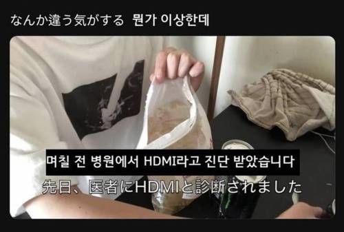 며칠 전 병원에서 HDMI라고 진단 받았습니다.